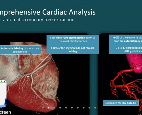Radiologi Unisa Yogyakarta Menyelenggarakan Webinar Internasional